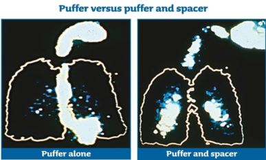 Inhaler graphic