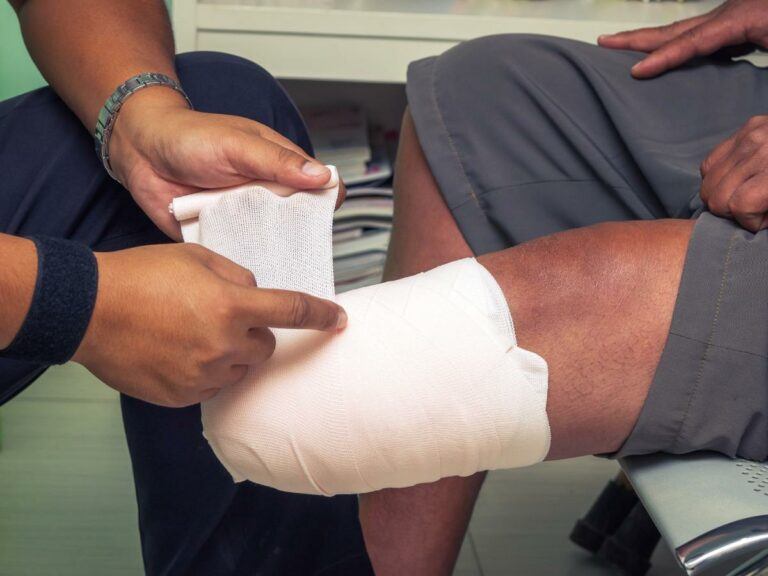 First Aid of Amputations