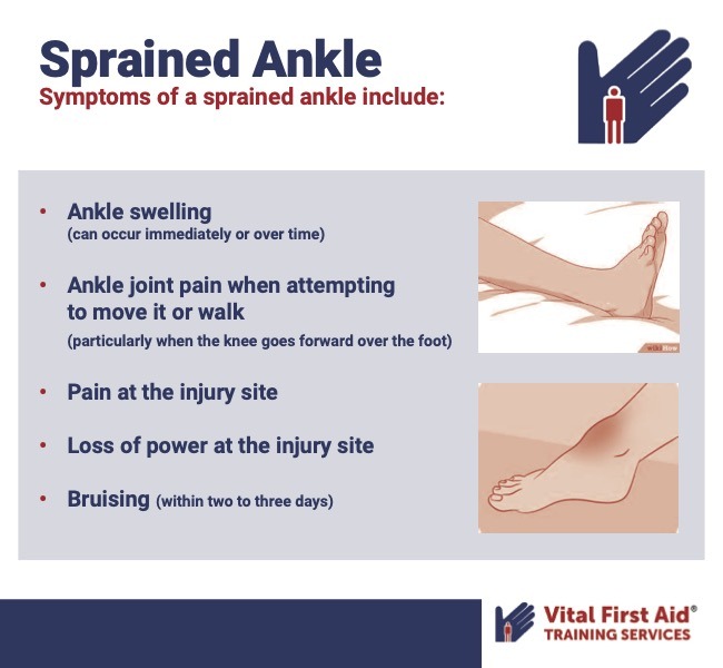 First Aid For Sprained Ankles: Signs, Symptoms & Treatment 1