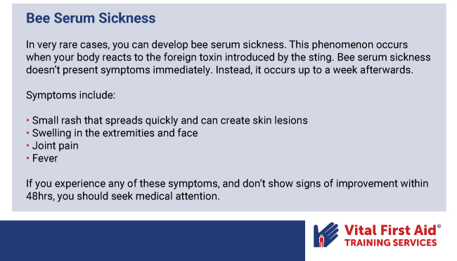 First Aid for Bee Stings Guide